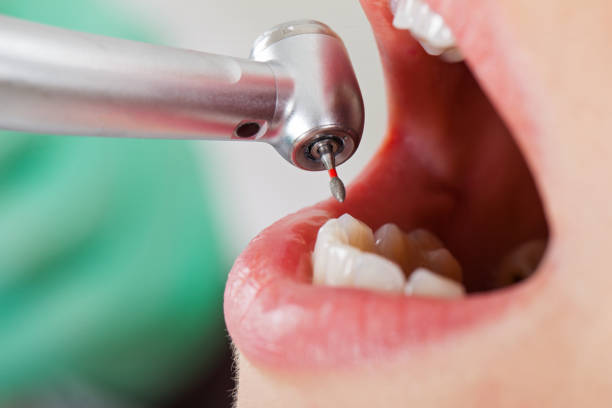 Best Emergency Dentist for Knocked-Out Tooth in Kill Devil Hills, NC